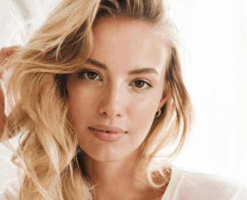 Fusion Med Spa answers all of your questions about microneedling