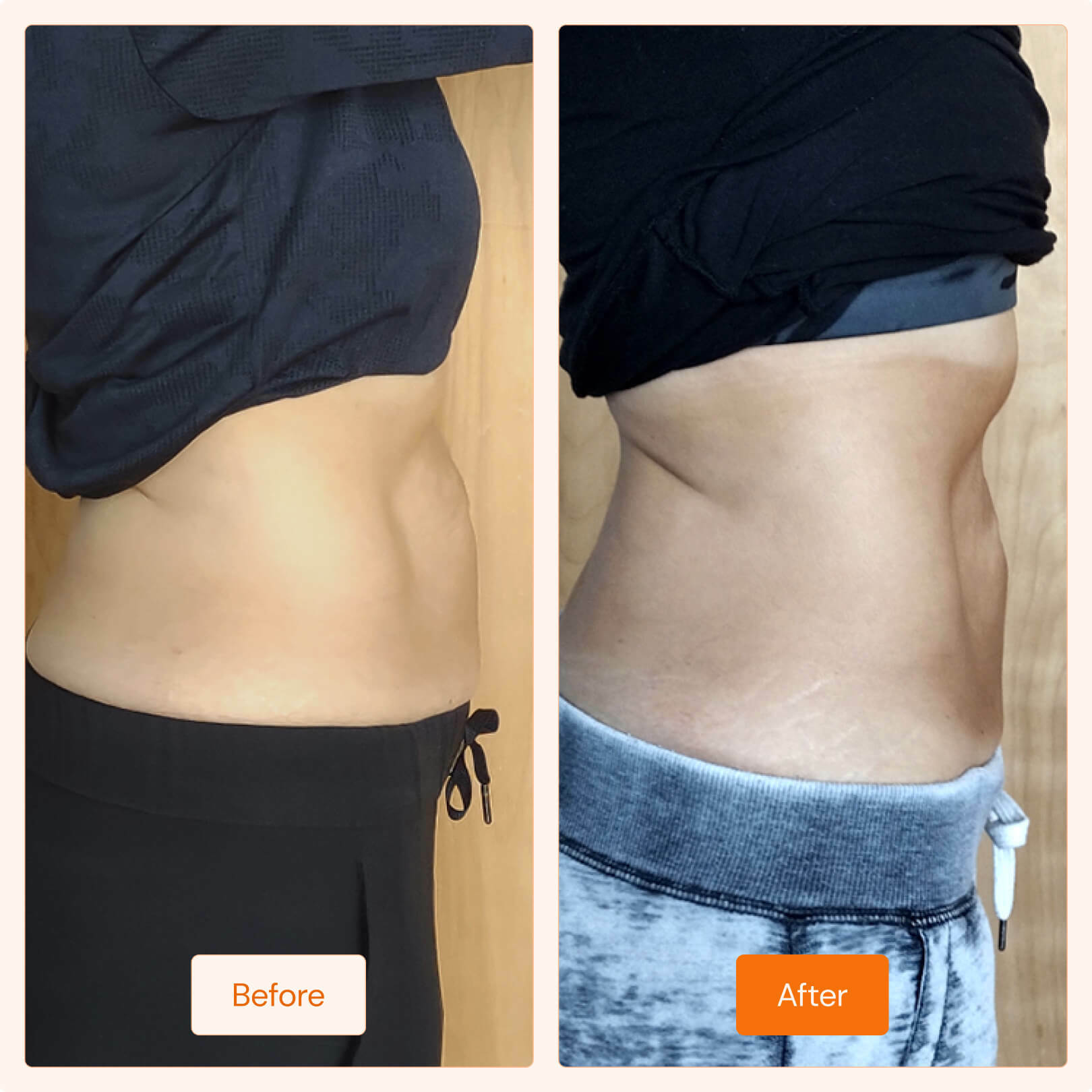 Lipocel results near me