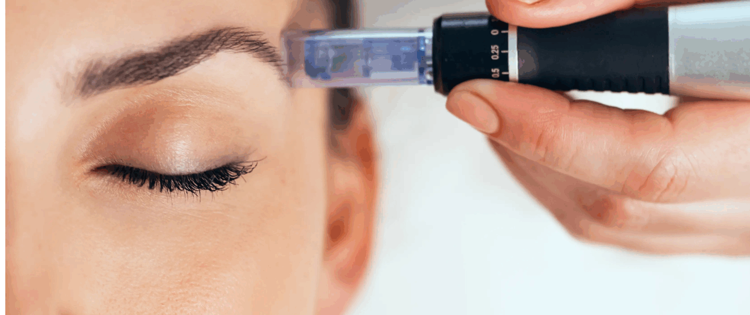 advanced microneedling at Naperville top Med Spa - Fusion Med Spa