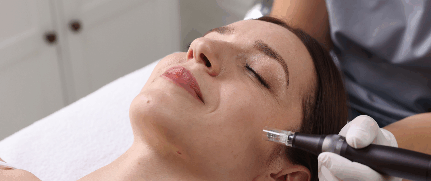 microneedling for fine lines and wrinkles at Fusion Med Spa in Naperville