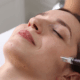 microneedling for fine lines and wrinkles at Fusion Med Spa in Naperville