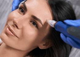SkinPen Naperville - Microneedling
