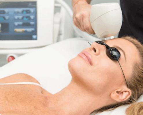 best IPL in naperville at Fusion Med Spa