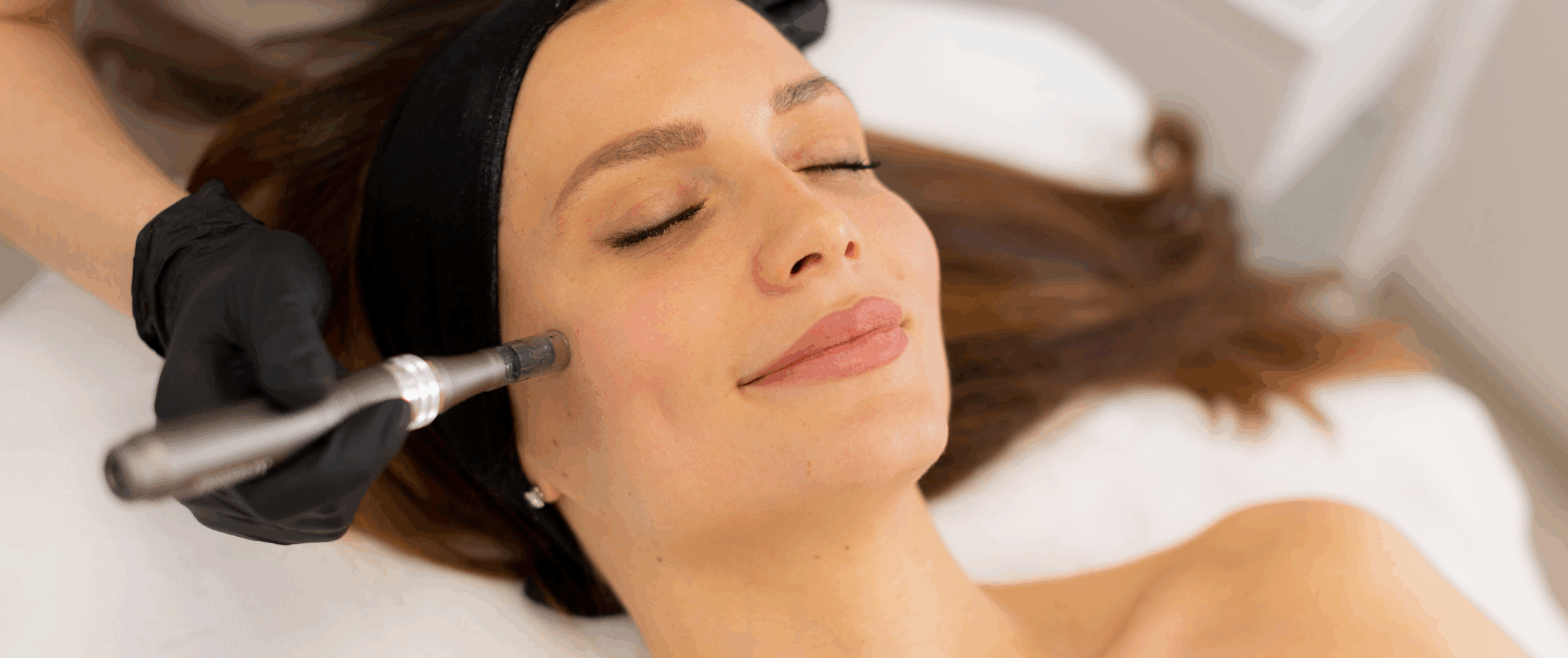 Microneedling vs RF Microneedling in Naperville at Fusion Med Spa