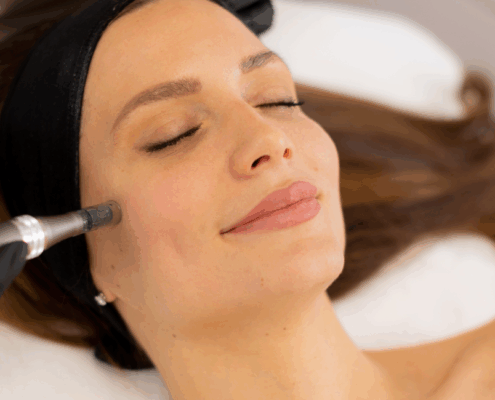 Microneedling vs RF Microneedling in Naperville at Fusion Med Spa