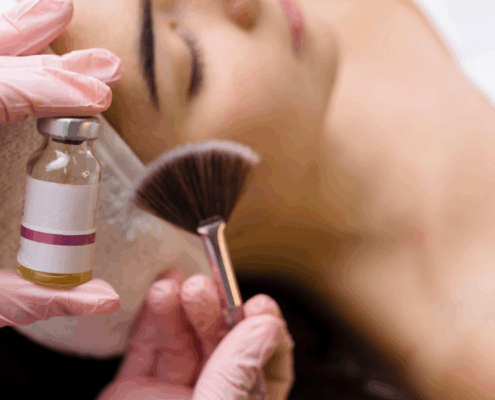 Fusion Med Spa in Naperville offers the best chemical peels