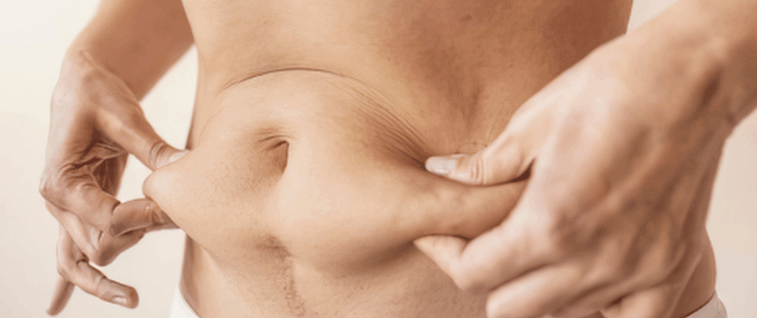 skin tightening in naperville il