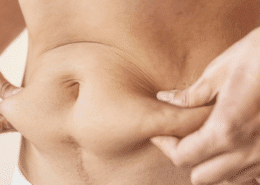 skin tightening in naperville il