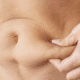 skin tightening in naperville il
