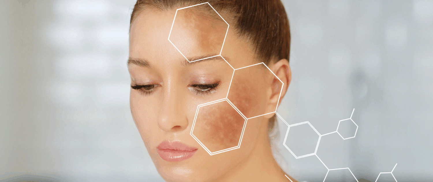 fusion Med Spa offers the best microneedling for melanoma in naperville