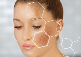 fusion Med Spa offers the best microneedling for melanoma in naperville