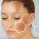 fusion Med Spa offers the best microneedling for melanoma in naperville