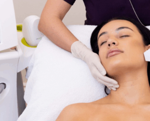 safe rf microneedling in naperville il