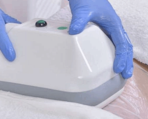 free your fat in naperville at Fusion Med Spa