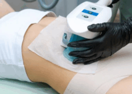 is cool sculpting right for you in naperville il