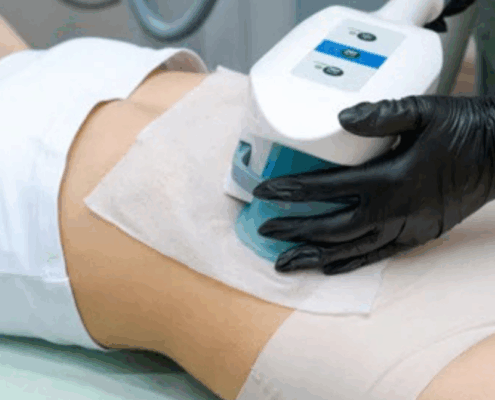 is cool sculpting right for you in naperville il