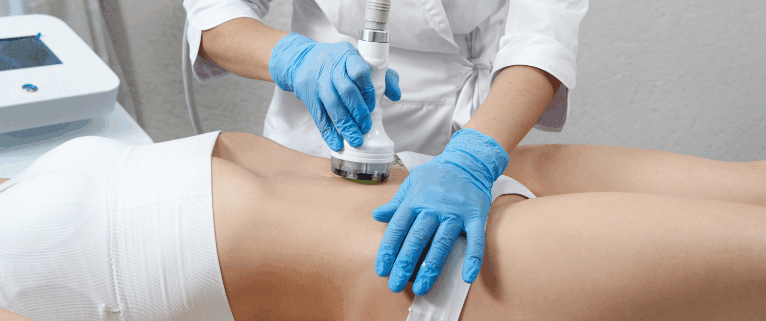 RF skin tightening in naperville il best radio frequency skin tightening in naperville at Fusion Med Spa