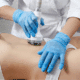 best radio frequency skin tightening in naperville at Fusion Med Spa