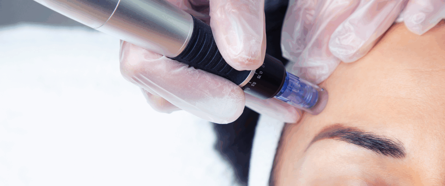 best Microneedling in Naperville if found at Fusion Med Spa