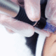 best Microneedling in Naperville if found at Fusion Med Spa