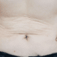 best saggy skin treatments in naperville at Fusion Med Spa