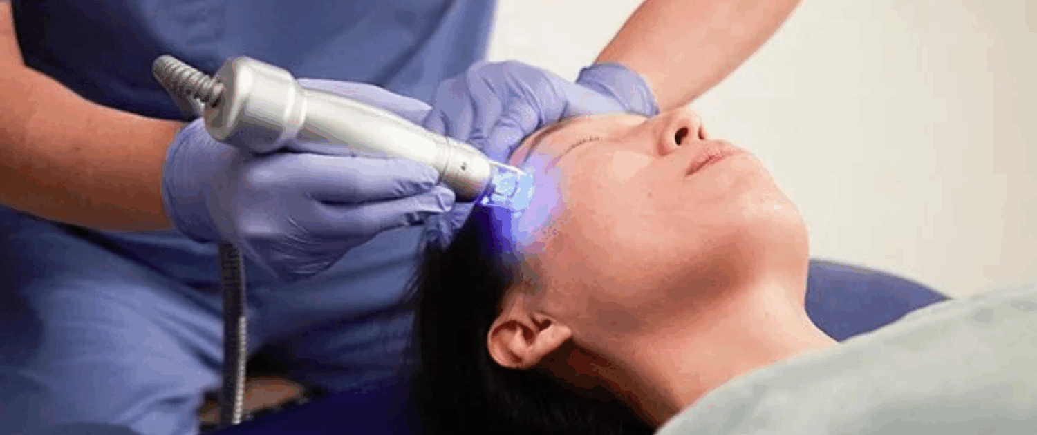 scarlet rf vs rf microneedling in naperville il Get the best RF Microneedling in Naperville at Fusion Med Spa