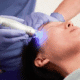 Get the best RF Microneedling in Naperville at Fusion Med Spa